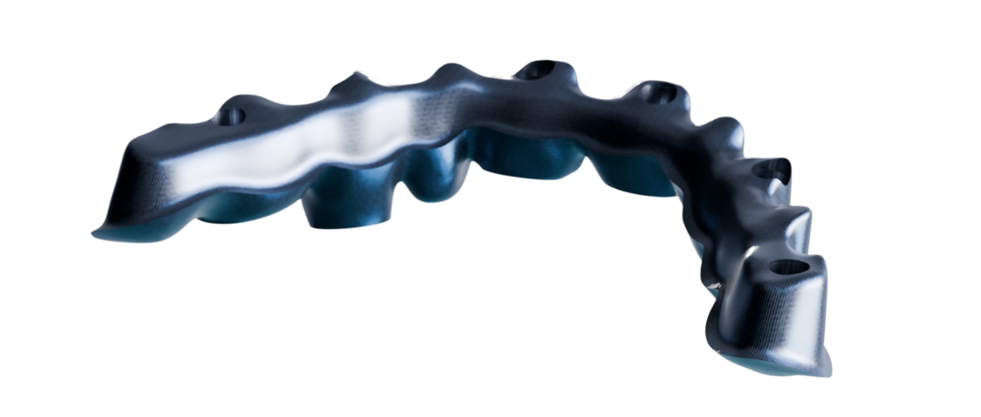 iBar métal — suprastructure zircone